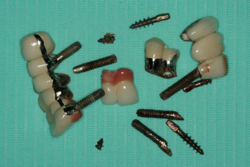 Adeslas Dental Familia Seguro Salud Castellon