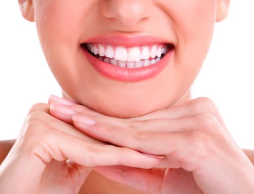 Blanqueamiento dental: Lo que debes saber antes de hacértelo
