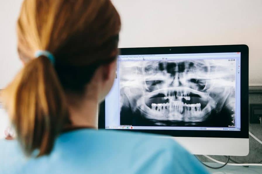 tratamiento_caries_odontopediatria caries_infantil_clinica_echeverria