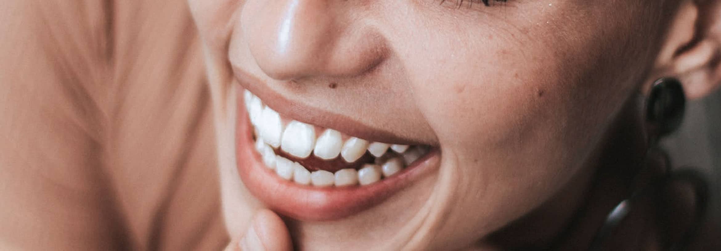 invisalign barcelona