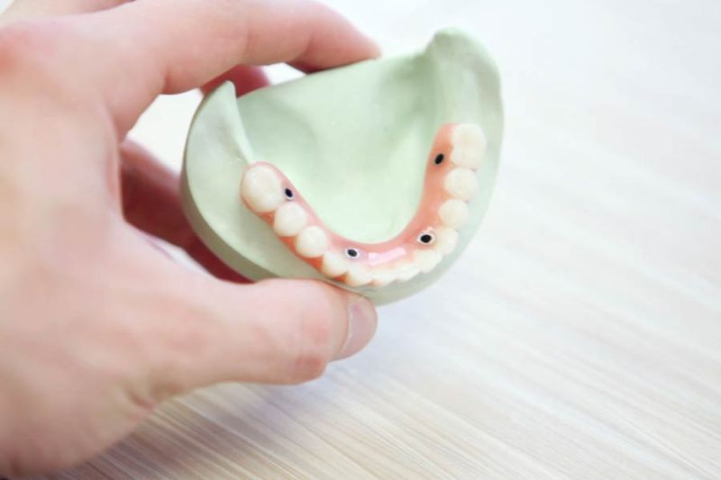 protesis-dental