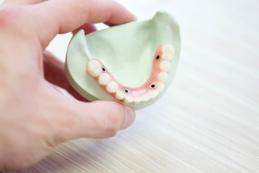 protesis-dental