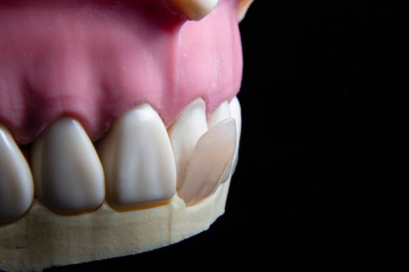 recomendaion-protesis-dental