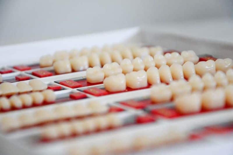 ventajas-protesis-dental